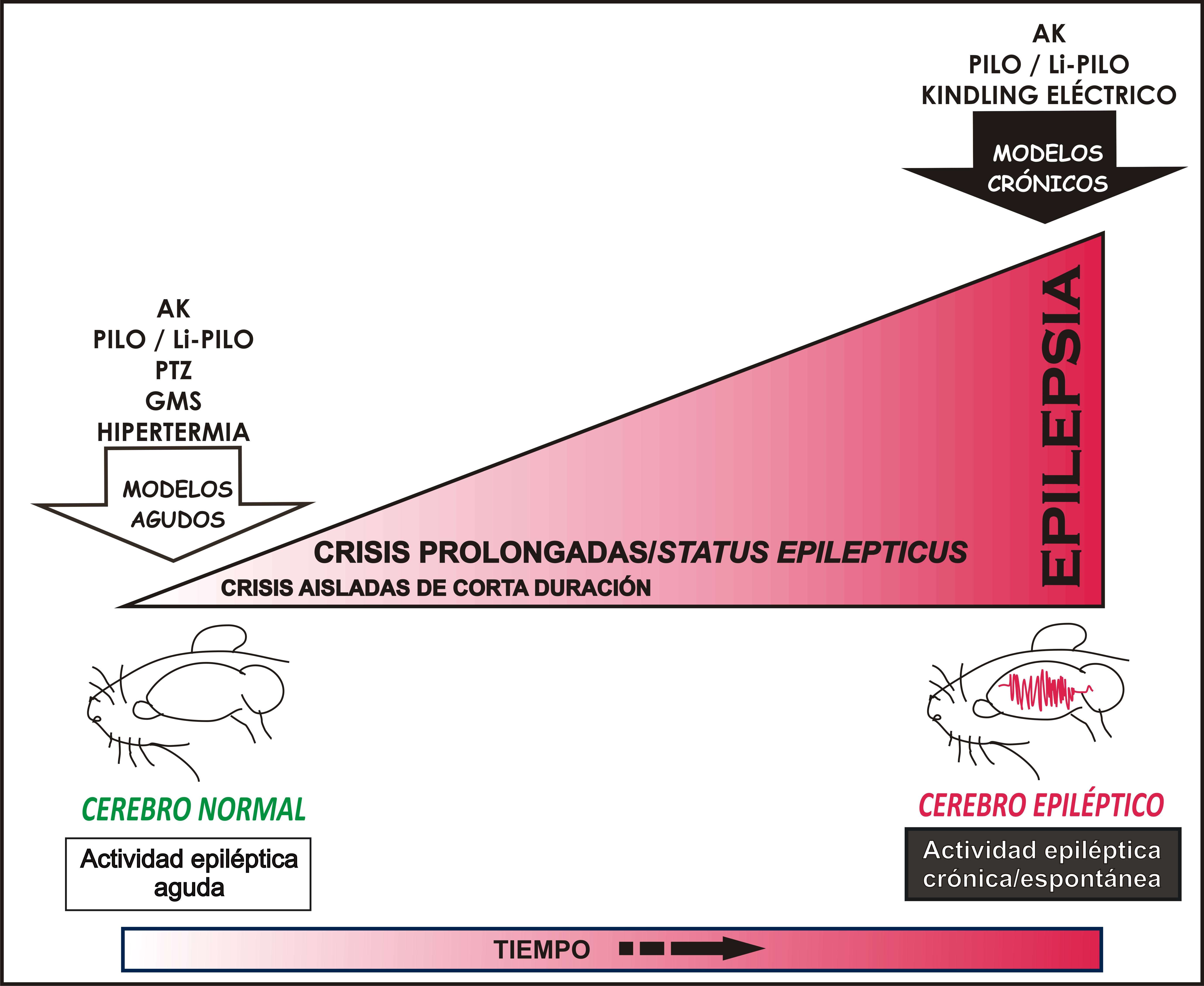 modelos agudos de epilepsia